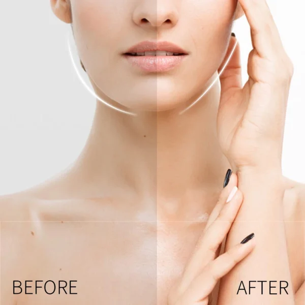 Parche de estiramiento Facial antiarrugas, pegatina para la frente, la mejilla y la barbilla, parches de estiramiento de la piel Facial antienvejecimiento, tiras eliminadoras de arrugas - Imagen 5