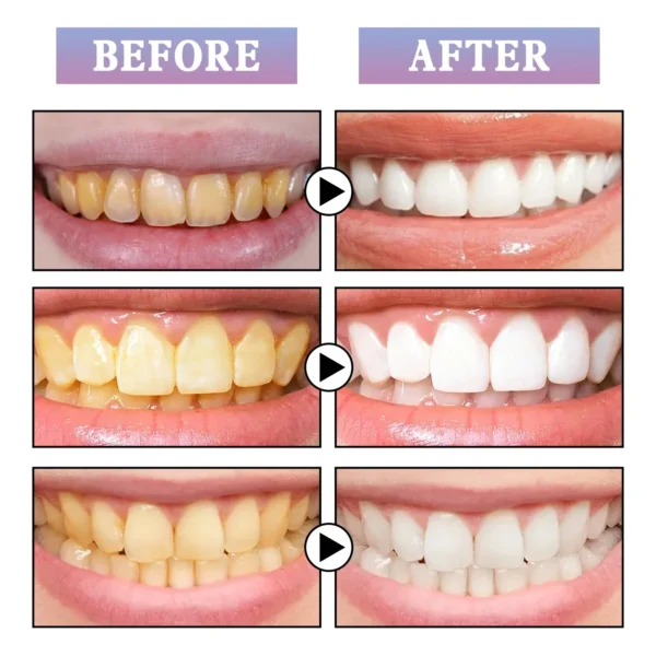 Kit de pintura para blanquear los dientes, eliminar pigmentos y manchas dentales, pintura blanca Natural instantánea, esmalte dental suave ajustado - Imagen 2
