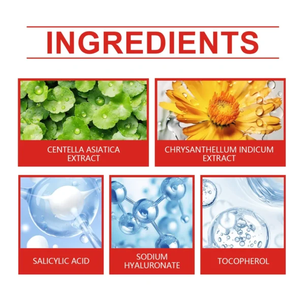 Parche para espinillas de alta gama, parches para acné en forma de corazón/estrella, parches de puntos para acné, hidrata para cubrir las imperfecciones y las imperfecciones 240 Uds. Nuevo - Imagen 5