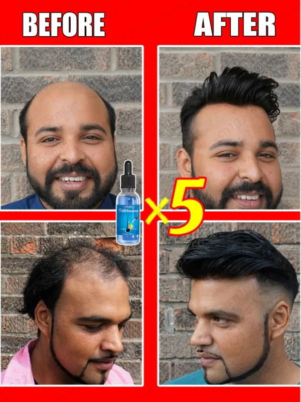 Repara la calvicie y la caída del cabello con aceite esencial, ten un cabello grueso en 7 días, estarás más joven y guapo con el cabello. - Imagen 2