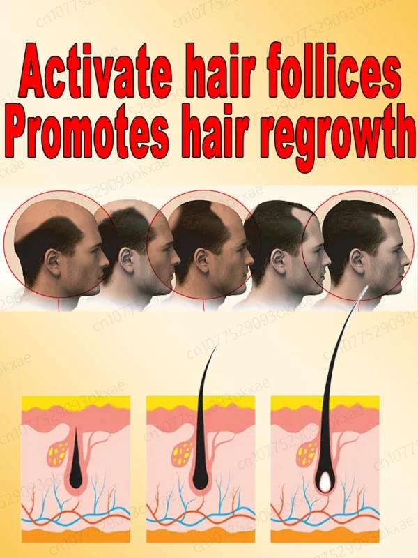 Repara la calvicie y la caída del cabello con aceite esencial, ten un cabello grueso en 7 días, estarás más joven y guapo con el cabello. - Imagen 6