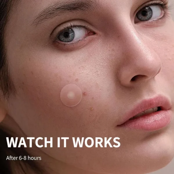 Parche para espinillas acné eliminación Invisible de acné pegatinas para el cuidado de la piel corrector mancha facial herramientas de maquillaje de belleza 360 uds/600 Uds - Imagen 5