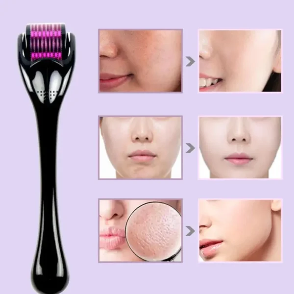 Rodillo Derma 540, aguja para el cuidado de la piel, Micro Dermaroller, rodillo Derma profesional para el crecimiento del cabello, rodillo de belleza Facial para el crecimiento de la barba - Imagen 3