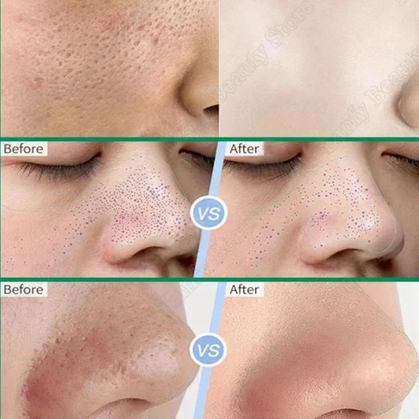 Crema limpiadora de poros de ácido salicílico, reduce los poros, elimina puntos negros, acné, ilumina, hidratante, suave, cuidado de la piel, productos coreanos - Imagen 3
