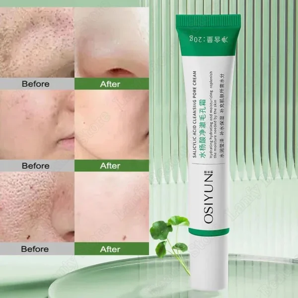 Crema limpiadora de poros de ácido salicílico, reduce los poros, elimina puntos negros, acné, ilumina, hidratante, suave, cuidado de la piel, productos coreanos - Imagen 5