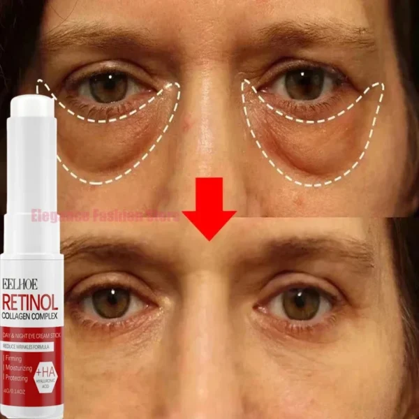Bolsa de ojos instantánea, crema para eliminar los ojos, partículas antigras, ojeras, hinchazón, decoloración de líneas finas, brillo, belleza coreana, cuidado de los ojos