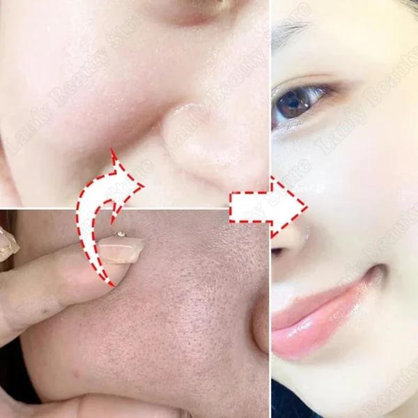 Crema limpiadora de poros de ácido salicílico, reduce los poros, elimina puntos negros, acné, ilumina, hidratante, suave, cuidado de la piel, productos coreanos - Imagen 2