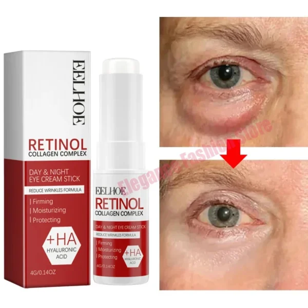 Bolsa de ojos instantánea, crema para eliminar los ojos, partículas antigras, ojeras, hinchazón, decoloración de líneas finas, brillo, belleza coreana, cuidado de los ojos - Imagen 6