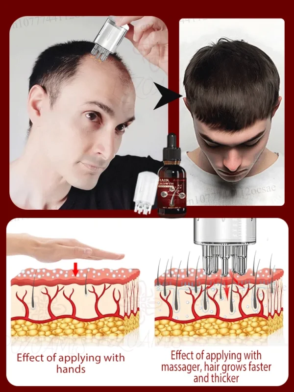 Peine de masaje con aceite esencial para el cabello, aplicador + esencia, acelera el crecimiento del cabello, cabello grueso en 5 días - Imagen 4