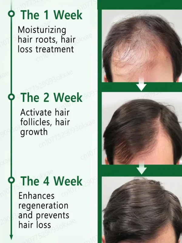 Peine de masaje con aceite esencial para el cabello, aplicador + esencia, acelera el crecimiento del cabello, cabello grueso en 5 días - Imagen 6