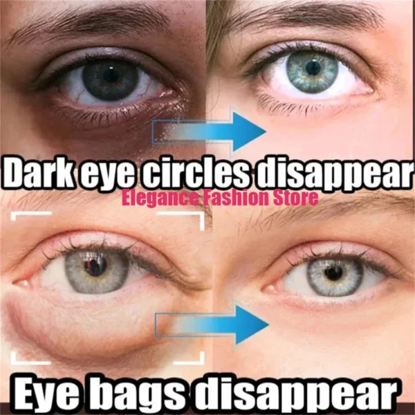 Bolsa de ojos instantánea, crema para eliminar los ojos, partículas antigras, ojeras, hinchazón, decoloración de líneas finas, brillo, belleza coreana, cuidado de los ojos - Imagen 3