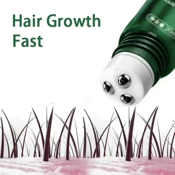 Aceite para el crecimiento del cabello, crecimiento rápido, reparación esencial efectiva de la calvicie, productos para la caída del cabello seborreico postparto hereditario - Imagen 2