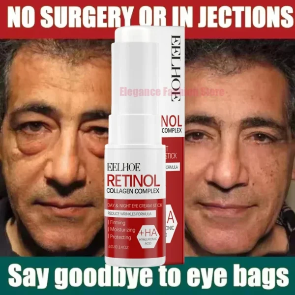 Bolsa de ojos instantánea, crema para eliminar los ojos, partículas antigras, ojeras, hinchazón, decoloración de líneas finas, brillo, belleza coreana, cuidado de los ojos - Imagen 2