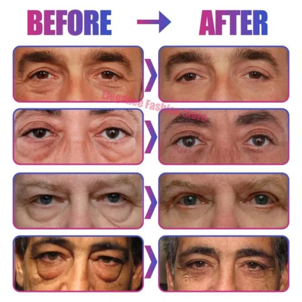 Bolsa de ojos instantánea, crema para eliminar los ojos, partículas antigras, ojeras, hinchazón, decoloración de líneas finas, brillo, belleza coreana, cuidado de los ojos - Imagen 4