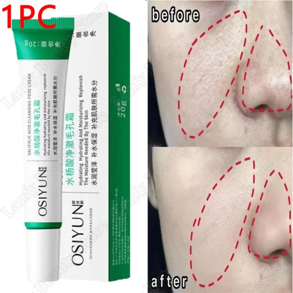 Crema limpiadora de poros de ácido salicílico, reduce los poros, elimina puntos negros, acné, ilumina, hidratante, suave, cuidado de la piel, productos coreanos - Imagen 9