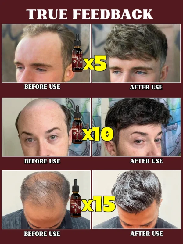 Peine de masaje con aceite esencial para el cabello, aplicador + esencia, acelera el crecimiento del cabello, cabello grueso en 5 días - Imagen 2