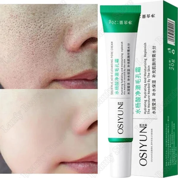 Crema limpiadora de poros de ácido salicílico, reduce los poros, elimina puntos negros, acné, ilumina, hidratante, suave, cuidado de la piel, productos coreanos