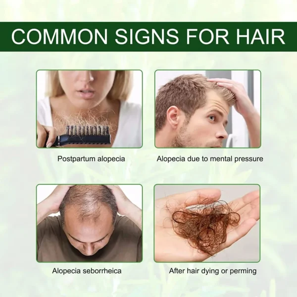 Aceite para el crecimiento del cabello, crecimiento rápido, reparación esencial efectiva de la calvicie, productos para la caída del cabello seborreico postparto hereditario - Imagen 6