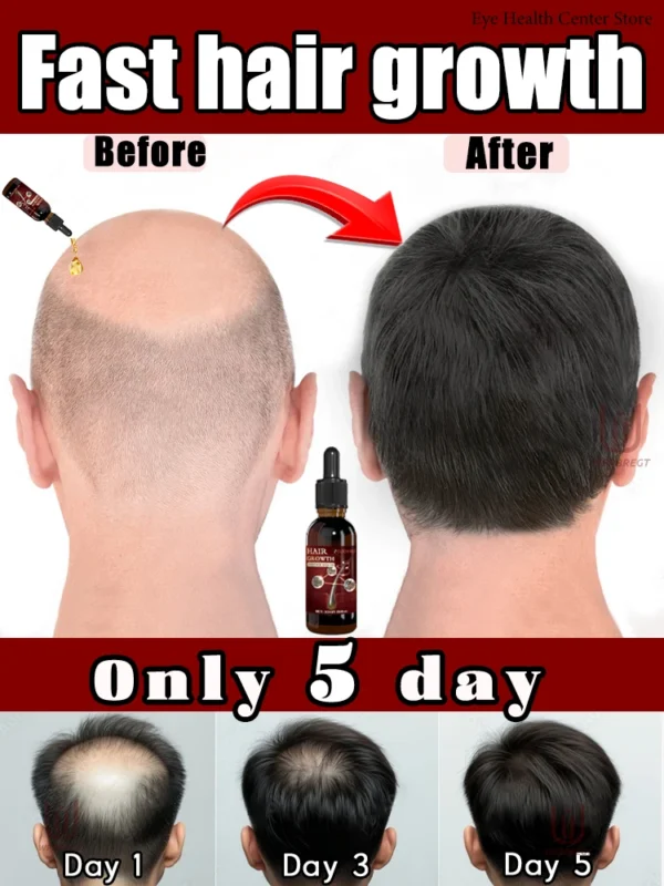 Peine de masaje con aceite esencial para el cabello, aplicador + esencia, acelera el crecimiento del cabello, cabello grueso en 5 días